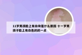 11岁男孩脸上有白块是什么原因 十一岁男孩子脸上有白色的的一点