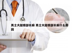 男士大腿根部长癣 男士大腿根部长癣什么原因