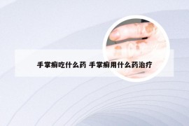 手掌癣吃什么药 手掌癣用什么药治疗