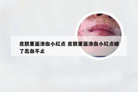 皮肤里面渗血小红点 皮肤里面渗血小红点破了出血不止