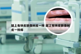 腿上有块皮肤像树皮一样 腿上有块皮肤像树皮一样痒