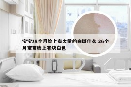 宝宝28个月脸上有大量的白斑什么 26个月宝宝脸上有块白色