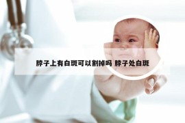 脖子上有白斑可以割掉吗 脖子处白斑