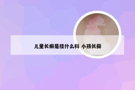 儿童长癣是挂什么科 小孩长藓