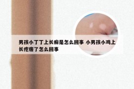 男孩小丁丁上长癣是怎么回事 小男孩小鸡上长疙瘩了怎么回事