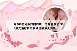 用308激光照好的白斑一个月复发了 308激光治疗白斑发红现象多久消失