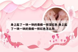 身上起了一块一块的像癣一样深红色 身上起了一块一块的像癣一样红色怎么办