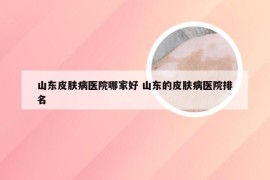 山东皮肤病医院哪家好 山东的皮肤病医院排名