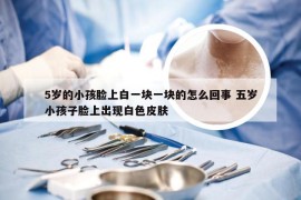 5岁的小孩脸上白一块一块的怎么回事 五岁小孩子脸上出现白色皮肤
