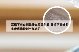 耳根下有白斑是什么原因引起 耳根下面好多小疙瘩像粉刺一样大的