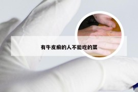 有牛皮癣的人不能吃的菜