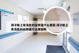 孩子脸上有浅色的白斑是什么原因 孩子脸上有浅色的白斑是什么原因呢