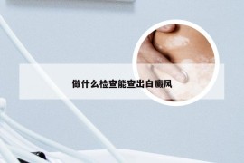 做什么检查能查出白癜风