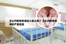 怎么判断银屑病进入静止期了 怎么判断银屑病的严重程度