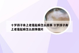 十岁孩子身上老是起癣怎么回事 十岁孩子身上老是起癣怎么回事图片