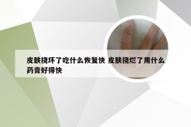 皮肤挠坏了吃什么恢复快 皮肤挠烂了用什么药膏好得快