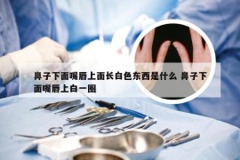 鼻子下面嘴唇上面长白色东西是什么 鼻子下面嘴唇上白一圈