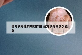 苗方肤毒康的功效作用 苗方肤毒康多少钱一盒