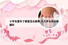 十岁女童长了癣是怎么回事 十几岁小孩长癣图片
