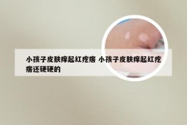 小孩子皮肤痒起红疙瘩 小孩子皮肤痒起红疙瘩还硬硬的
