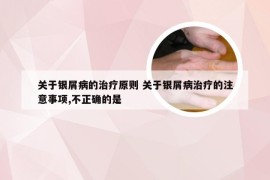 关于银屑病的治疗原则 关于银屑病治疗的注意事项,不正确的是