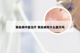 银血病中医治疗 银血病有什么偏方吗