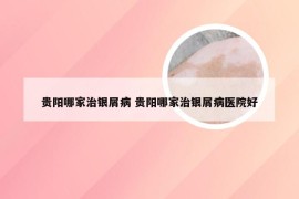 贵阳哪家治银屑病 贵阳哪家治银屑病医院好