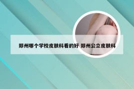 郑州哪个学校皮肤科看的好 郑州公立皮肤科