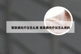 银屑病光疗仪怎么用 银屑病光疗仪怎么用的