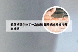 银屑病偶尔吃了一次辣椒 银屑病吃辣椒几天出症状