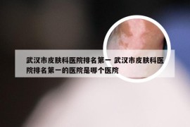 武汉市皮肤科医院排名第一 武汉市皮肤科医院排名第一的医院是哪个医院