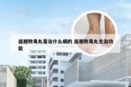 连翘败毒丸是治什么病的 连翘败毒丸主治功能