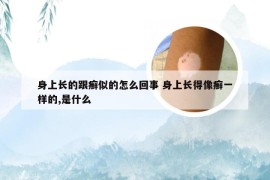 身上长的跟癣似的怎么回事 身上长得像癣一样的,是什么