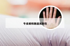 牛皮癣和肠道关联性