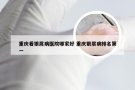 重庆看银屑病医院哪家好 重庆银屑病排名第一