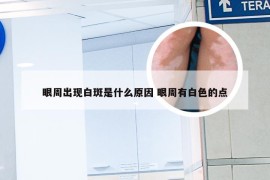 眼周出现白斑是什么原因 眼周有白色的点