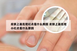 皮肤上面出现红点是什么原因 皮肤上面出现小红点是什么原因