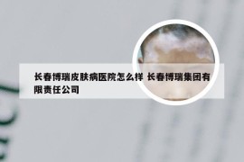 长春博瑞皮肤病医院怎么样 长春博瑞集团有限责任公司