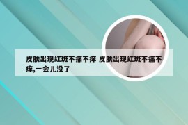 皮肤出现红斑不痛不痒 皮肤出现红斑不痛不痒,一会儿没了