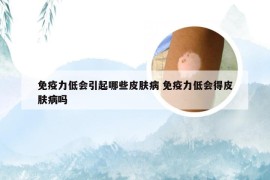 免疫力低会引起哪些皮肤病 免疫力低会得皮肤病吗