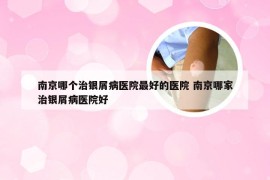南京哪个治银屑病医院最好的医院 南京哪家治银屑病医院好