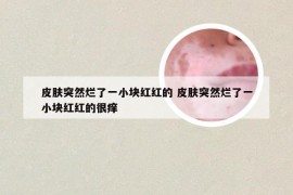 皮肤突然烂了一小块红红的 皮肤突然烂了一小块红红的很痒