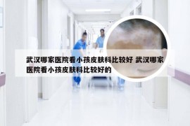 武汉哪家医院看小孩皮肤科比较好 武汉哪家医院看小孩皮肤科比较好的