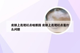 皮肤上出现红点啥原因 皮肤上出现红点是什么问题