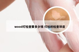wood灯检查要多少钱 灯检的检查项目