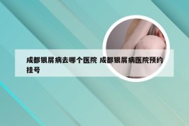 成都银屑病去哪个医院 成都银屑病医院预约挂号