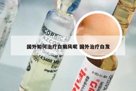 国外如何治疗白癜风呢 国外治疗白发