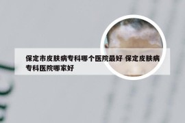 保定市皮肤病专科哪个医院最好 保定皮肤病专科医院哪家好
