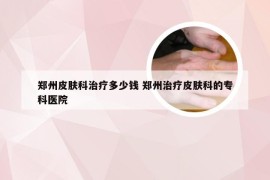 郑州皮肤科治疗多少钱 郑州治疗皮肤科的专科医院