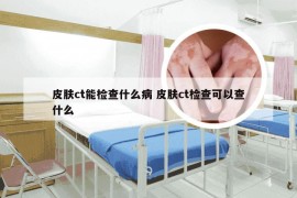 皮肤ct能检查什么病 皮肤ct检查可以查什么